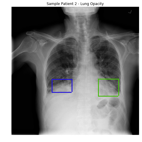 Explainable COVID-19 Pneumonia – Engineering AI Agents